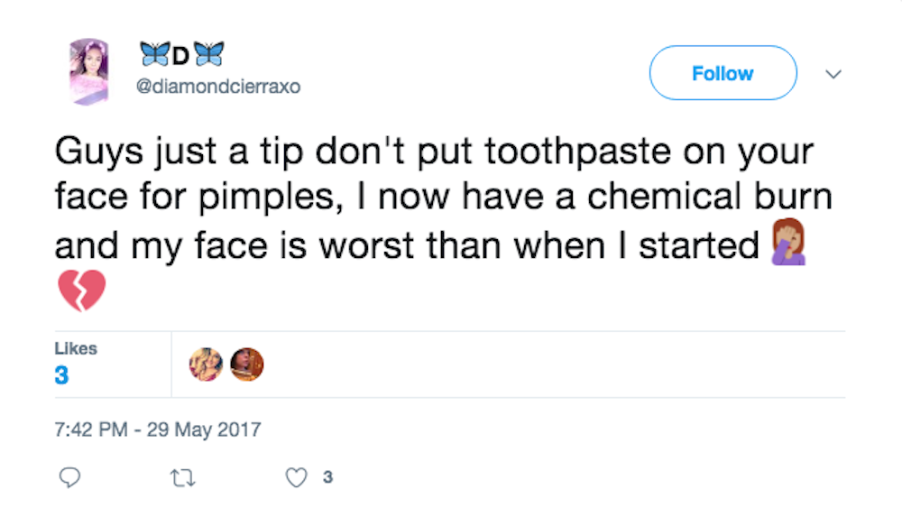 ENTITY shares why you shouldn’t put toothpaste on pimples