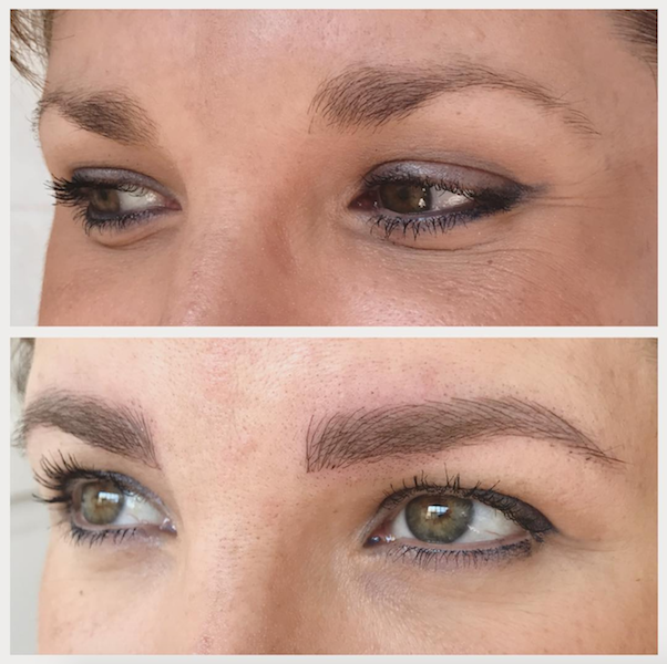 ENTITY reports on microblading