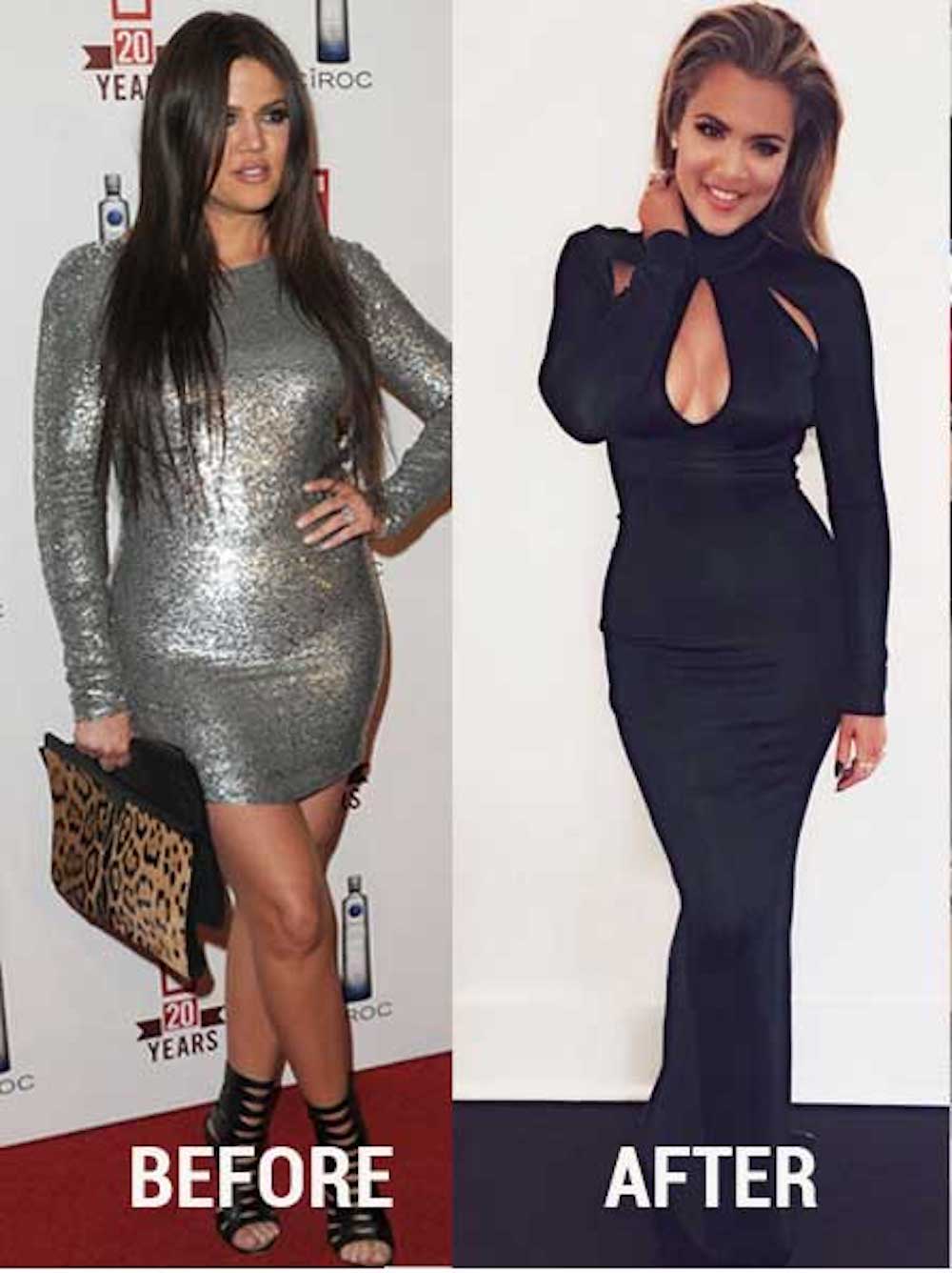 ENTITY reports on Khloe Kardashian waist trainer.
